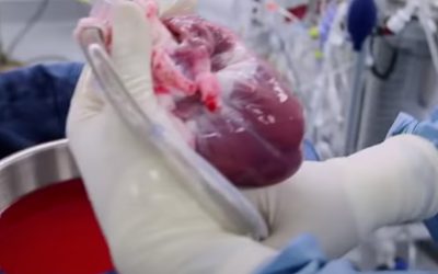 Heart Transplantation
