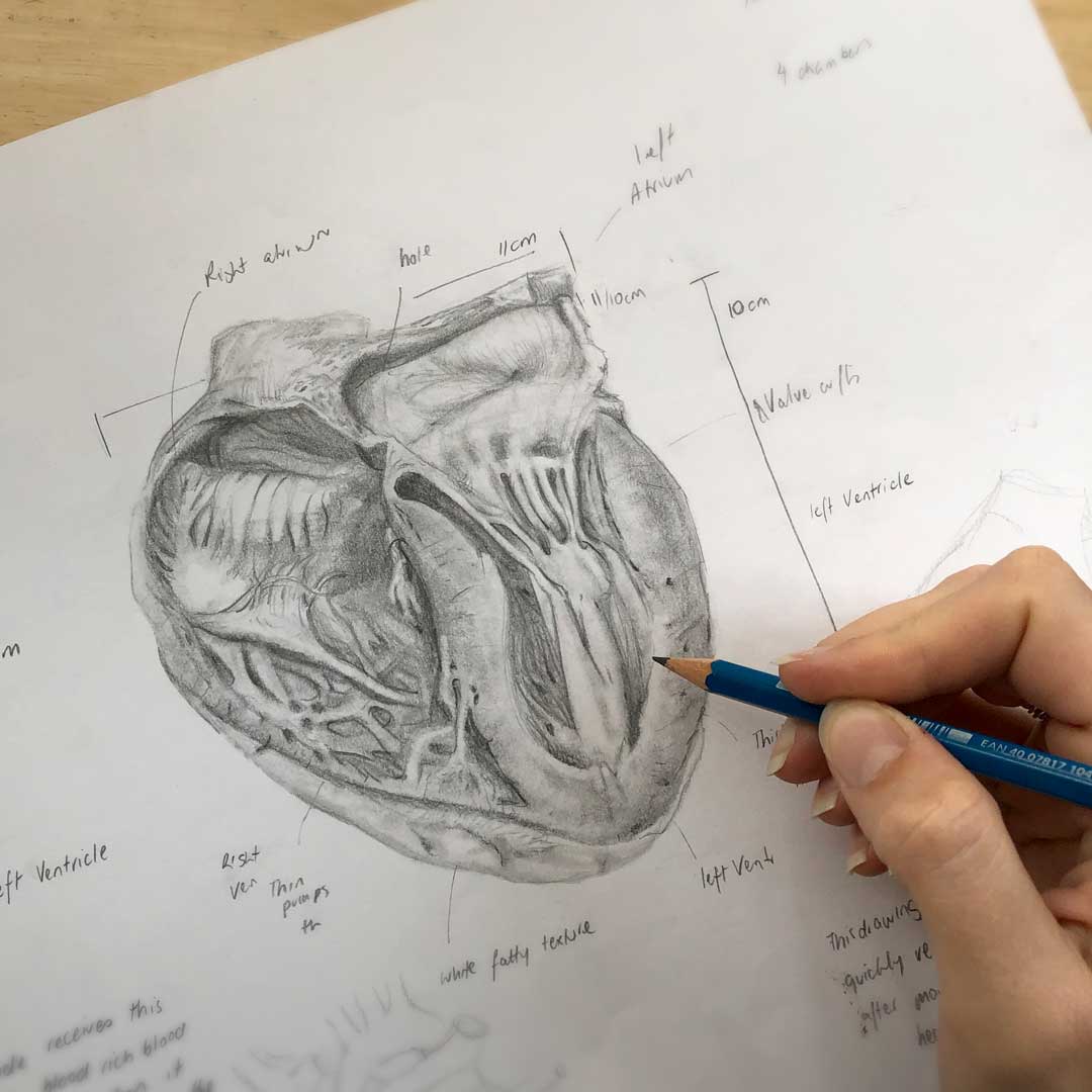 Anatomical Heart Sketch for GSSE Spot tests - Surgical Illustration by Ayeesha McComb