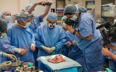 Face Transplant Surgery