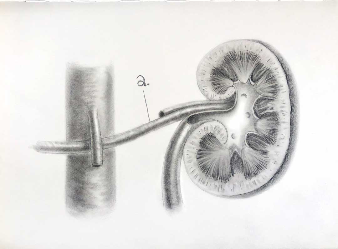 GSSE Spotter – The Kidney – Primary Anatomy GSSE Spot test, GSSE Spotter, visually test GSSE candidates anatomy knowledge (GSSE question bank)