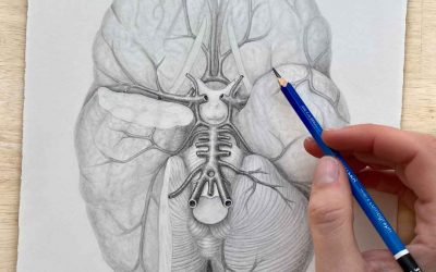 The Circle of Willis