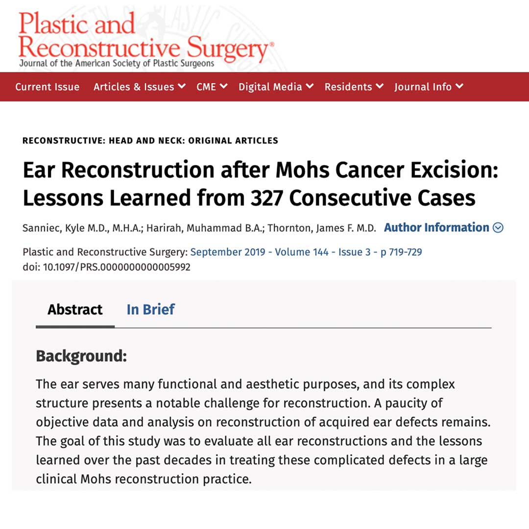 Ear Reconstruction Techniques – Primary Anatomy Journal article describing ear reconstructive techniques for plastic surgeons and trainees - surgical education