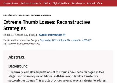Reconstructive techniques for extreme thumb losses - hand trauma - plastic surgery and orthopaedics