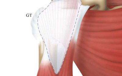 An unusual variant of the origin of Biceps Brachii