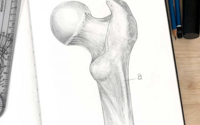 Femoral Head – Spot Test