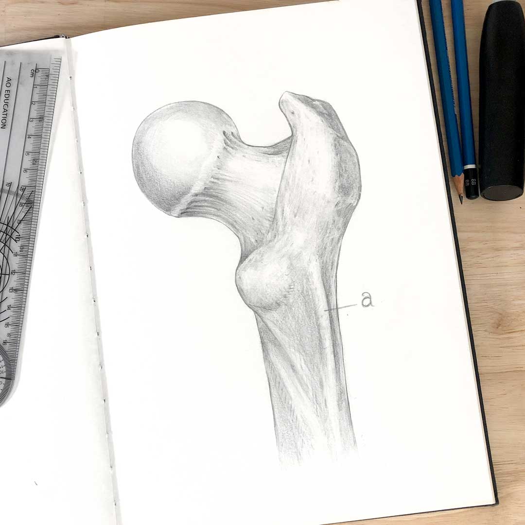 GSSE Spot Test – Femoral Head – Primary Anatomy GSSE Spot test on the anatomy of the femoral head to assist with GSSE preparation