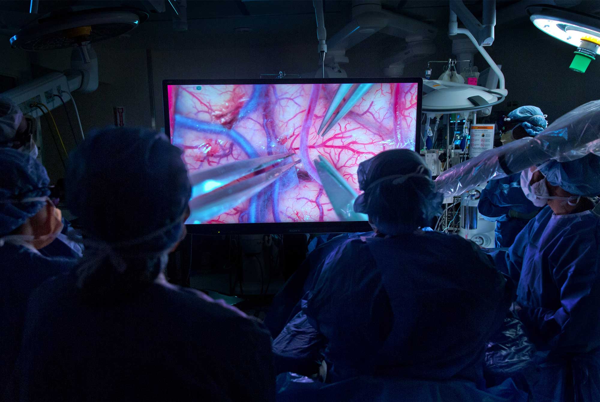 3D Exoscope – Primary Anatomy – GSSE Educating surgeons and surgical trainees on the latest surgical technologies and innovations - GSSE