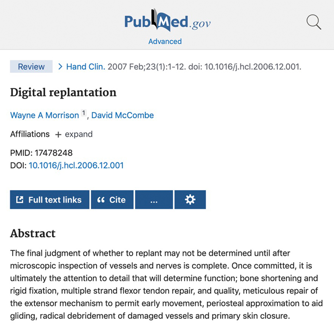 Primary Anatomy – GSSE Anatomy – GSSE Study – Digital Replantati Review article on digital replantation for GSSE and surgical trainees