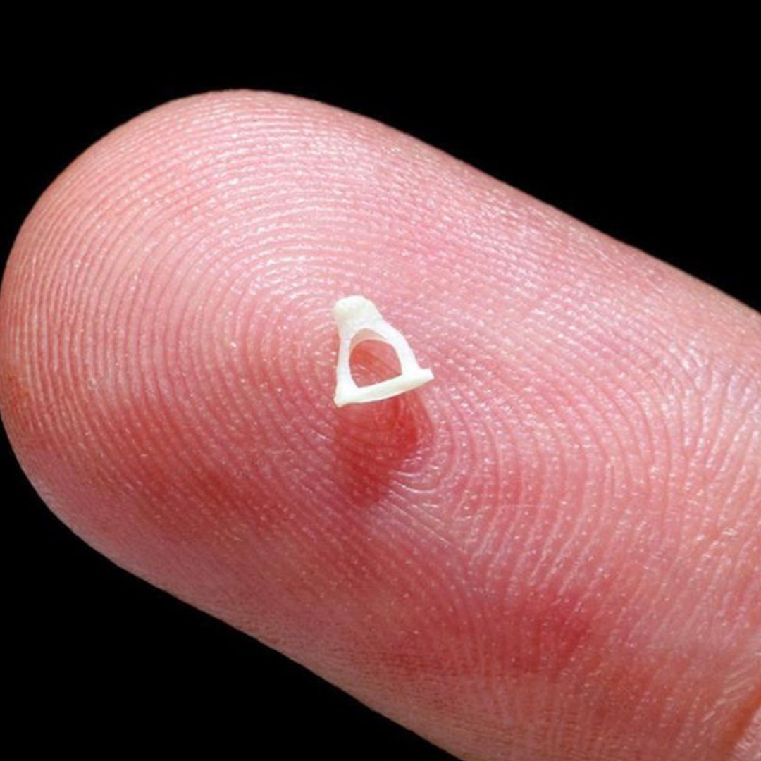 Primary Anatomy – Stapes Ossicle