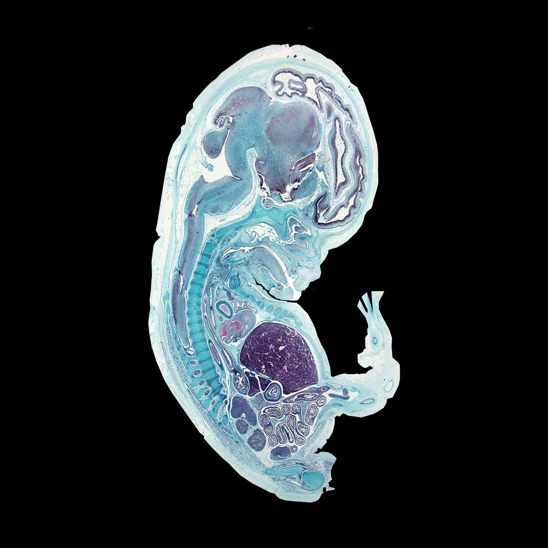 Surgical Embryology – Primary Anatomy – GSSE preparation