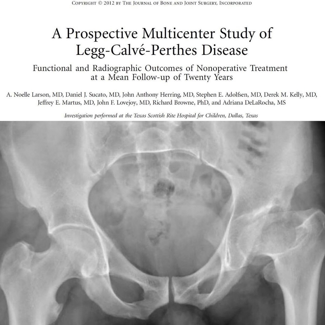 Perthe’s Hip – Primary Anatomy – Orthopaedic Surgery JBJS